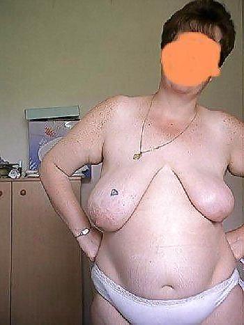 14P The Beauty of Fucked Up Tits Big and Small