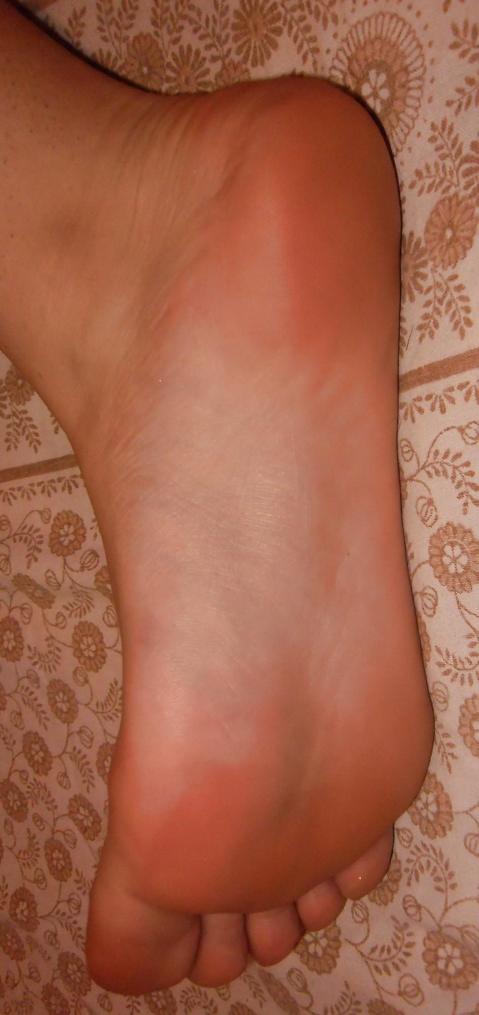 20P Christina 's Feet - Foot models sole + spreads flexible toes
