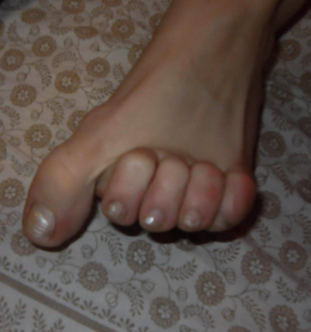 20P Christina 's Feet - Foot models sole + spreads flexible toes