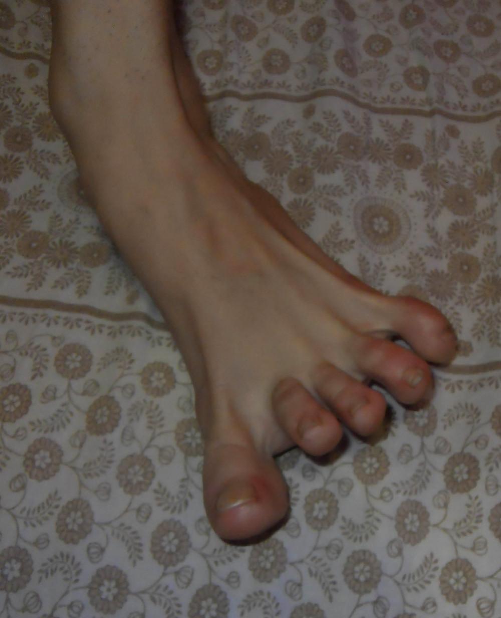 20P Christina 's Feet - Foot models sole + spreads flexible toes