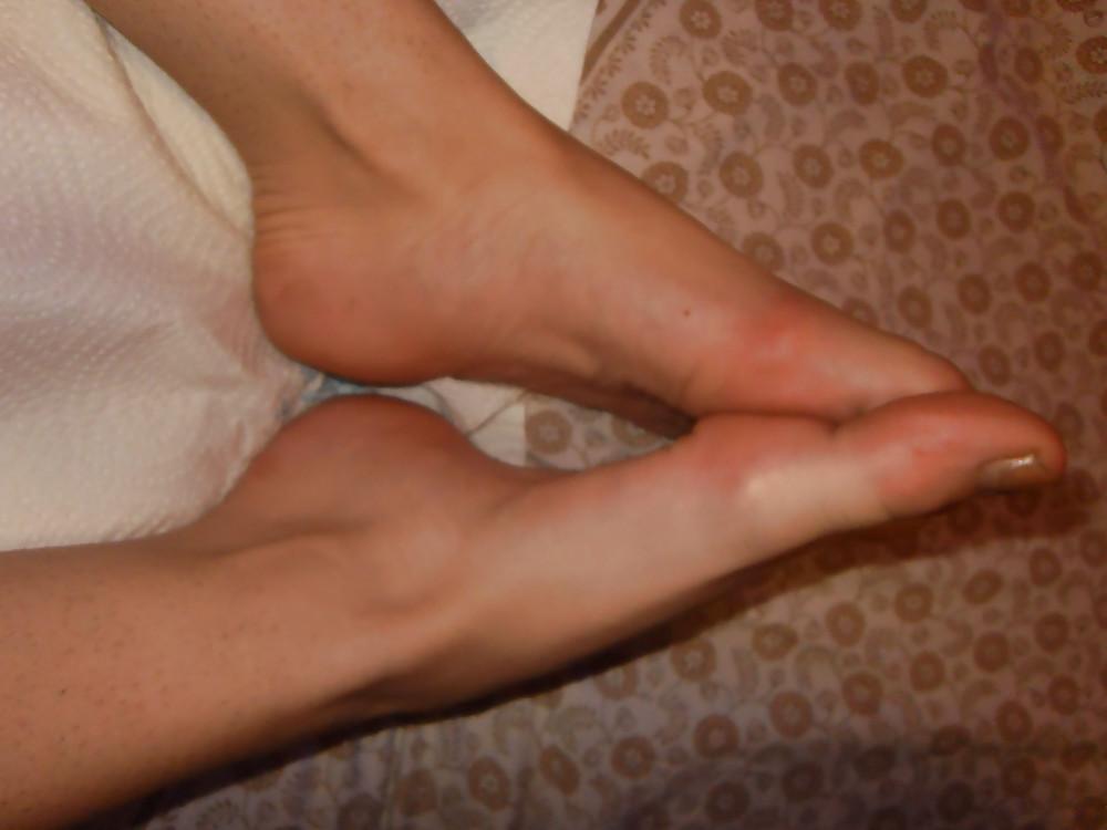 20P Christina 's Feet - Foot models sole + spreads flexible toes