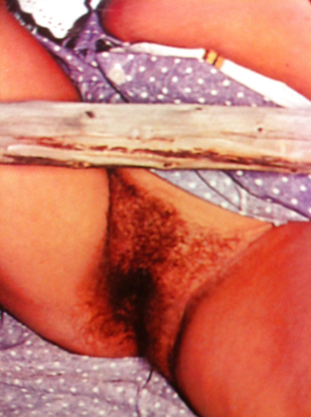 11P Hairy teen