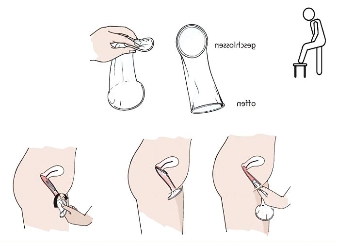 4P Female Condom