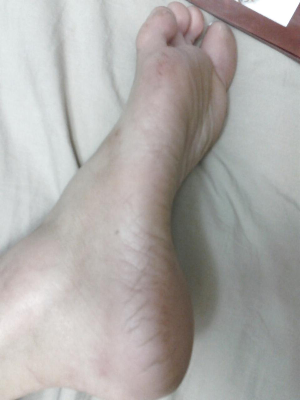 13P Foot fetish