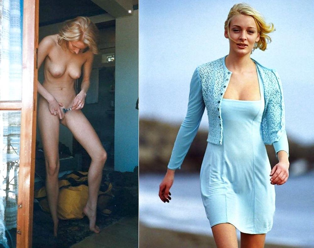 25P Dressed & undressed #8