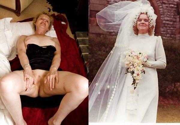 25P Dessed  and undressed Brides