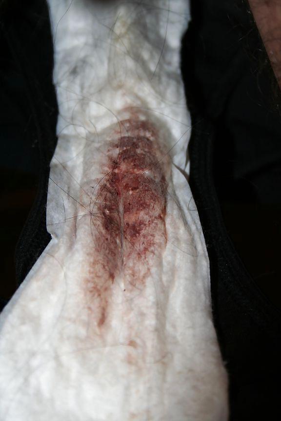 12P Badeanzug und Miederhose