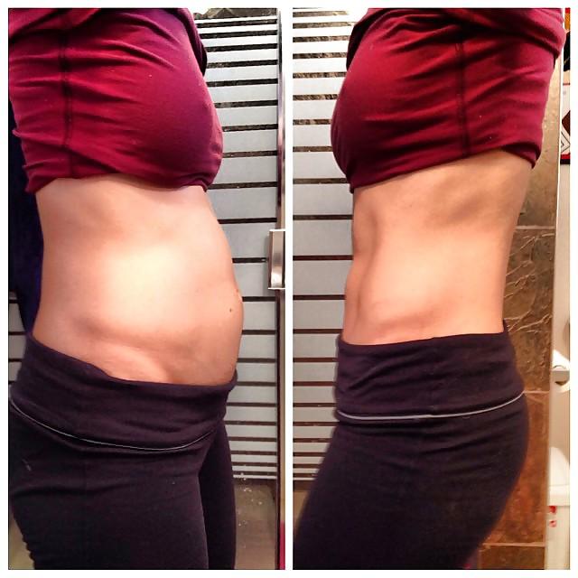 25P Weight gain and food babies