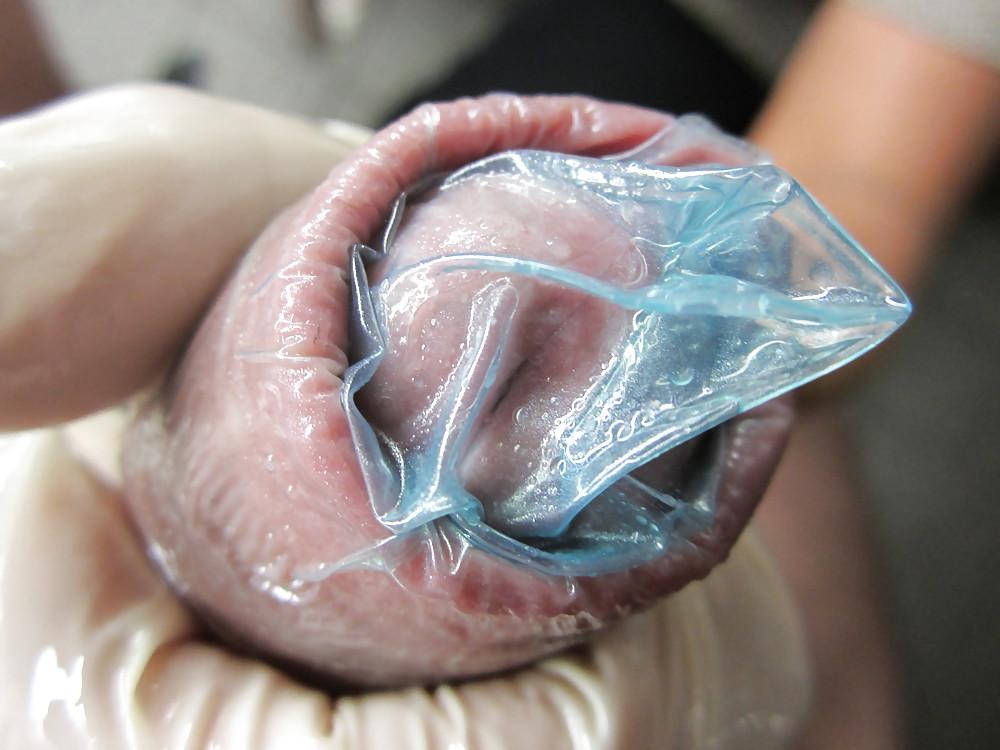 6P Alles mit Condom 10