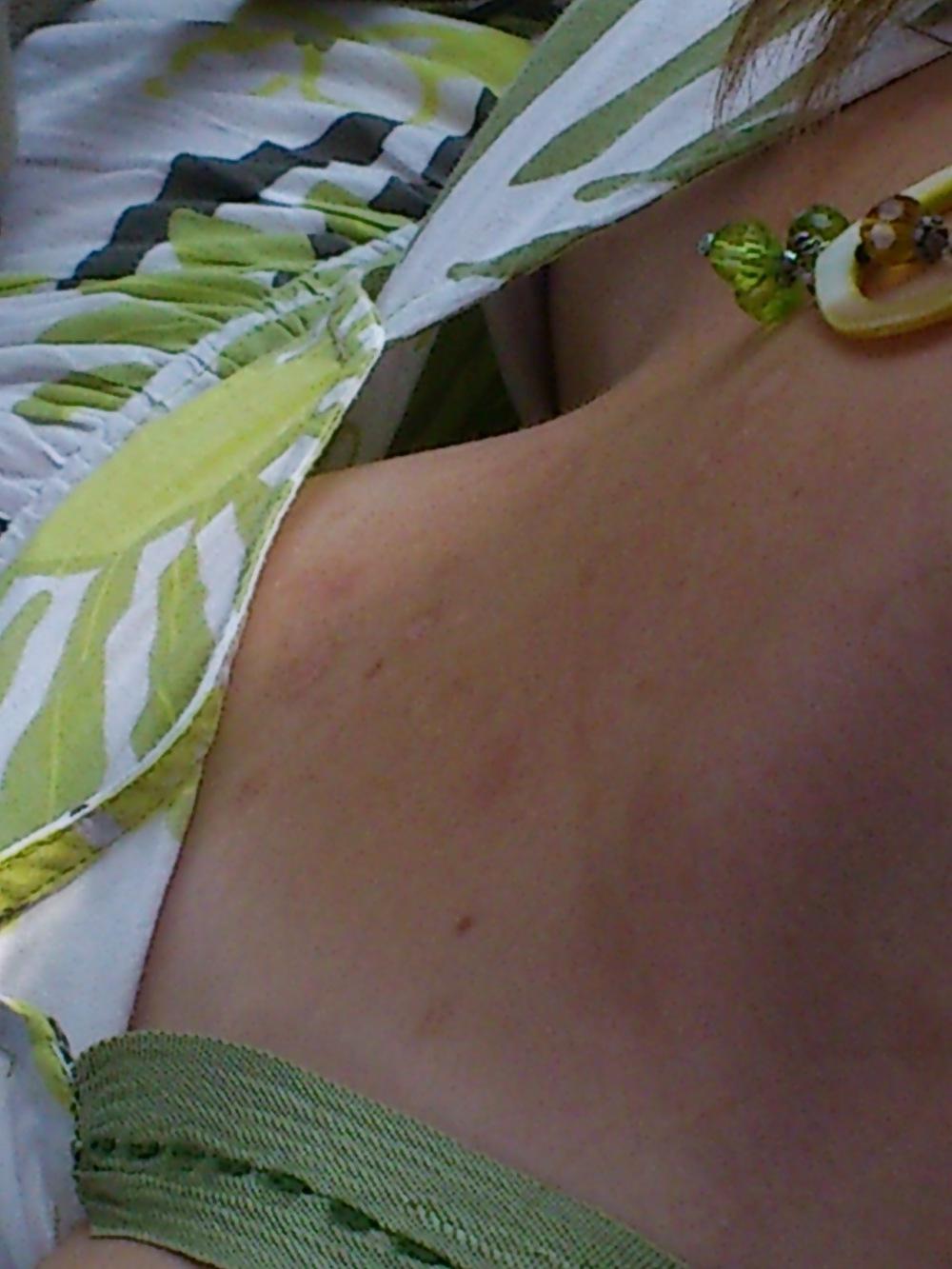 25P Downblouse, Part 5