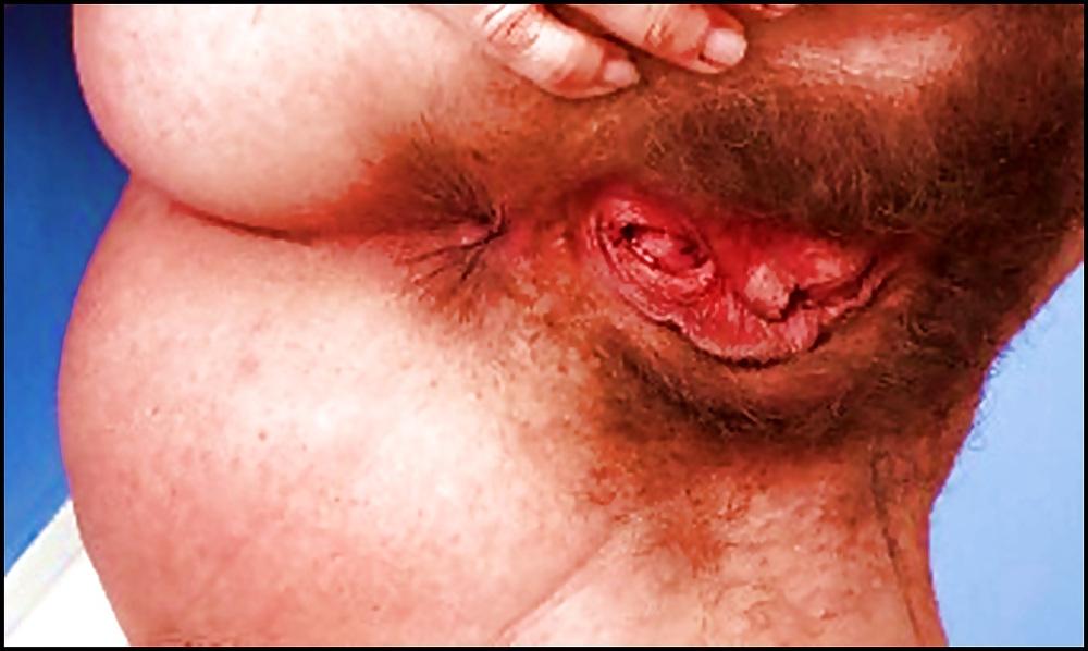 14P Open pussy Northeastern Brazil