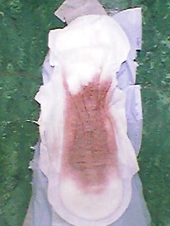 18P PAD