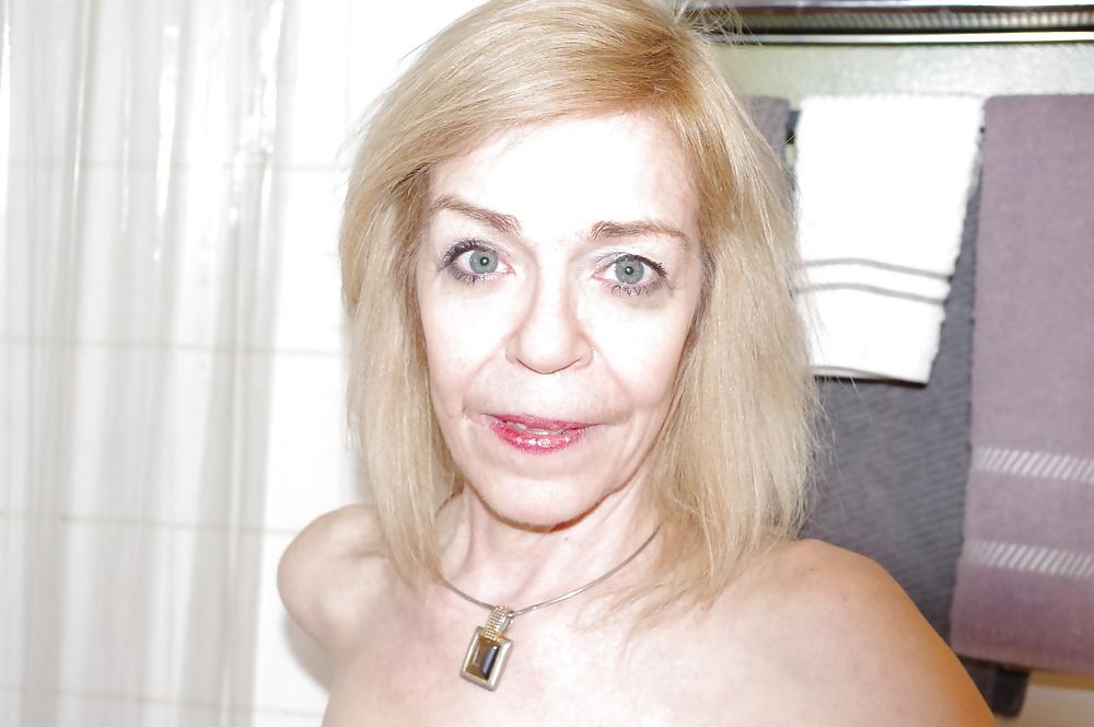 21P Skinny hairy 60 y old