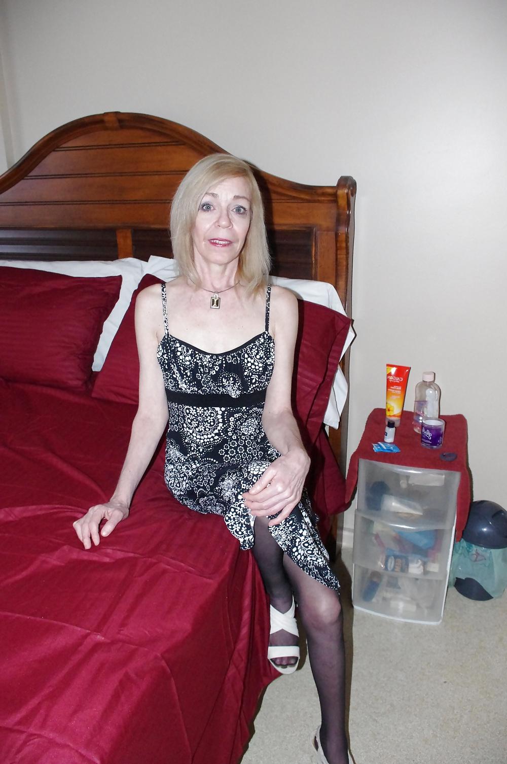 21P Skinny hairy 60 y old