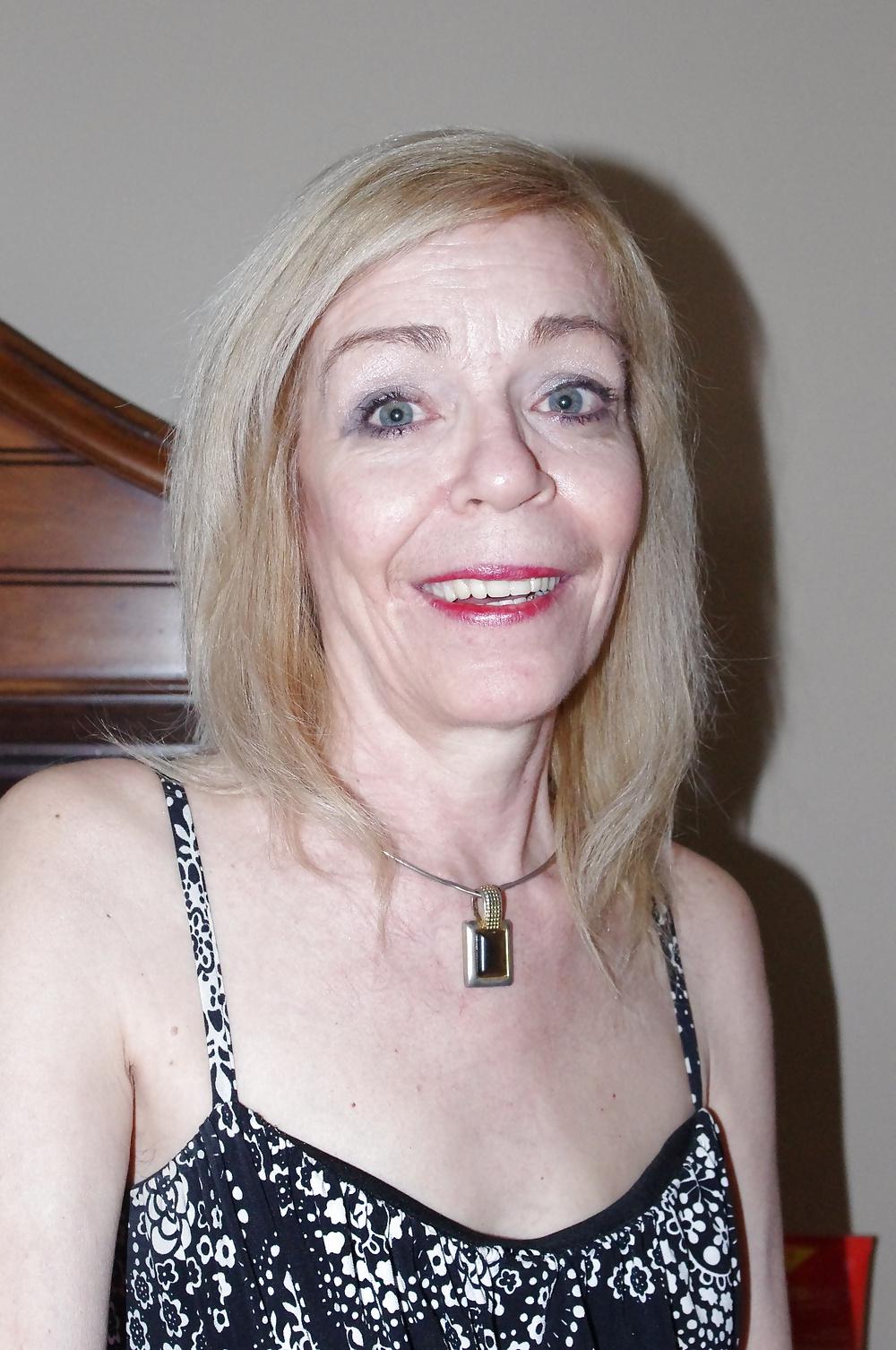 21P Skinny hairy 60 y old