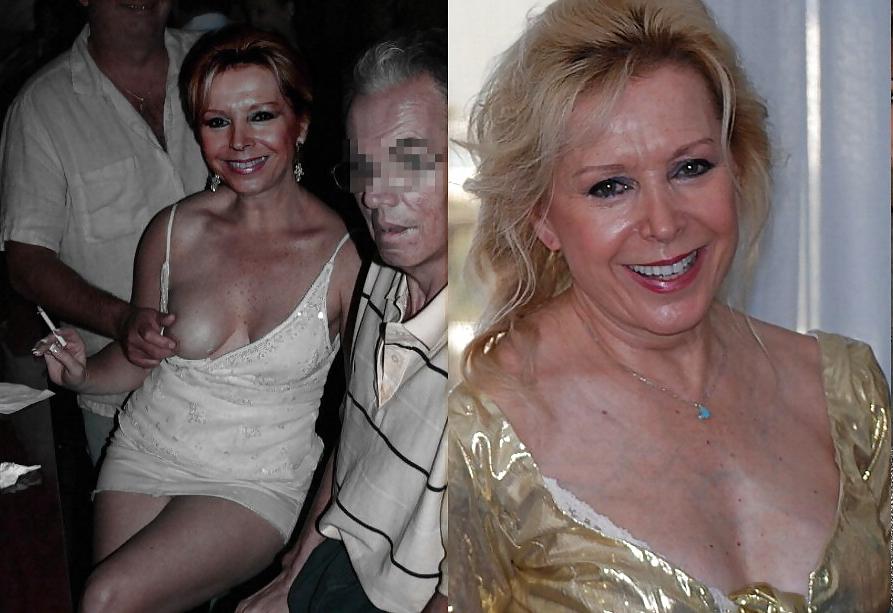 25P Milfs and gilfs, before and after