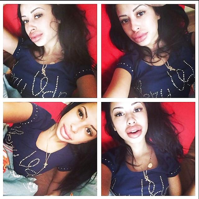 25P Big Lips Beauty Anya Khachaturyan (Apparently) 