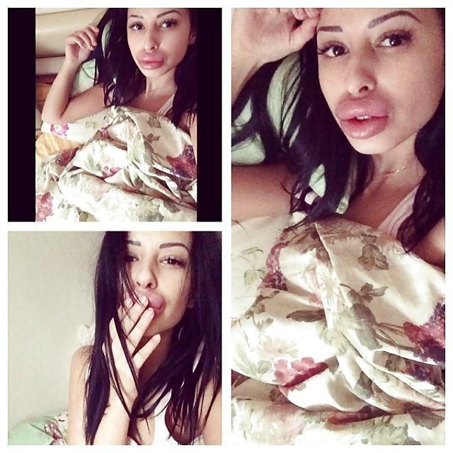 25P Big Lips Beauty Anya Khachaturyan (Apparently) 