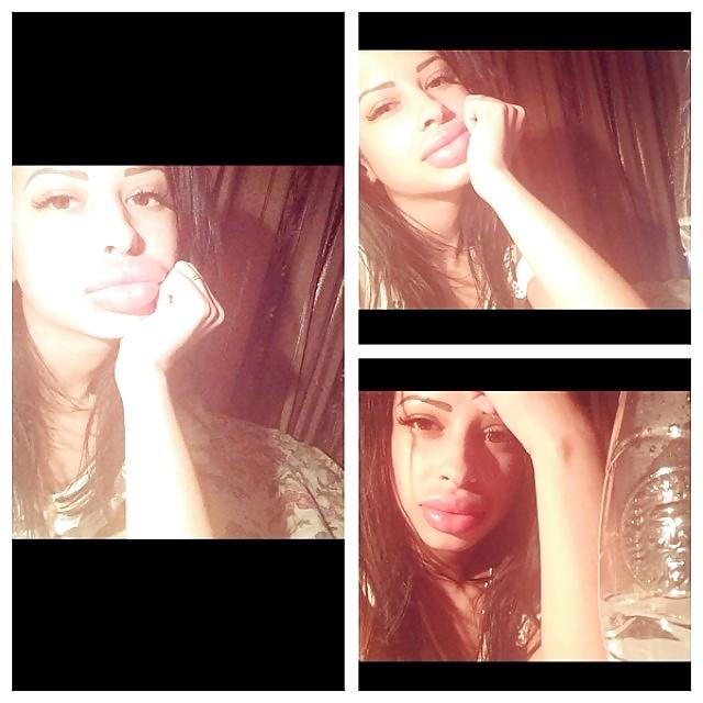 25P Big Lips Beauty Anya Khachaturyan (Apparently) 
