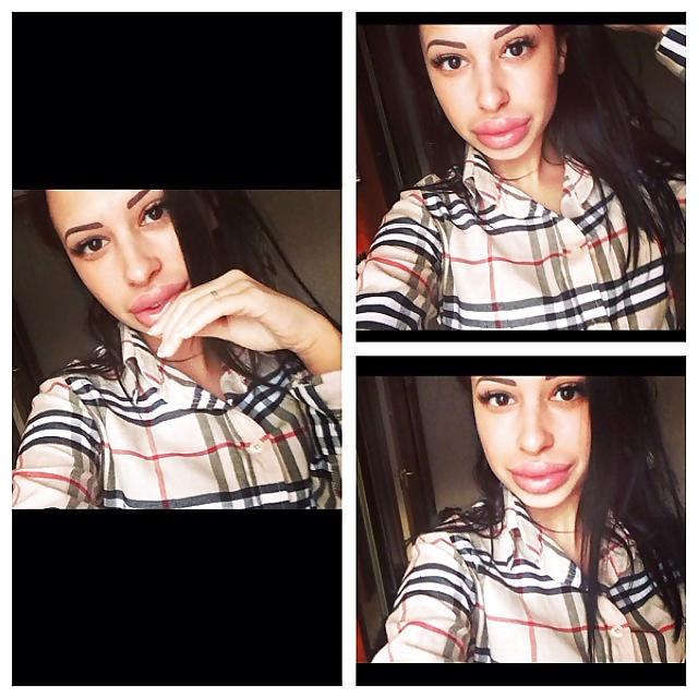 25P Big Lips Beauty Anya Khachaturyan (Apparently) 