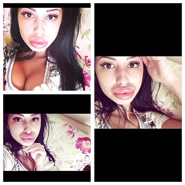 25P Big Lips Beauty Anya Khachaturyan (Apparently) 