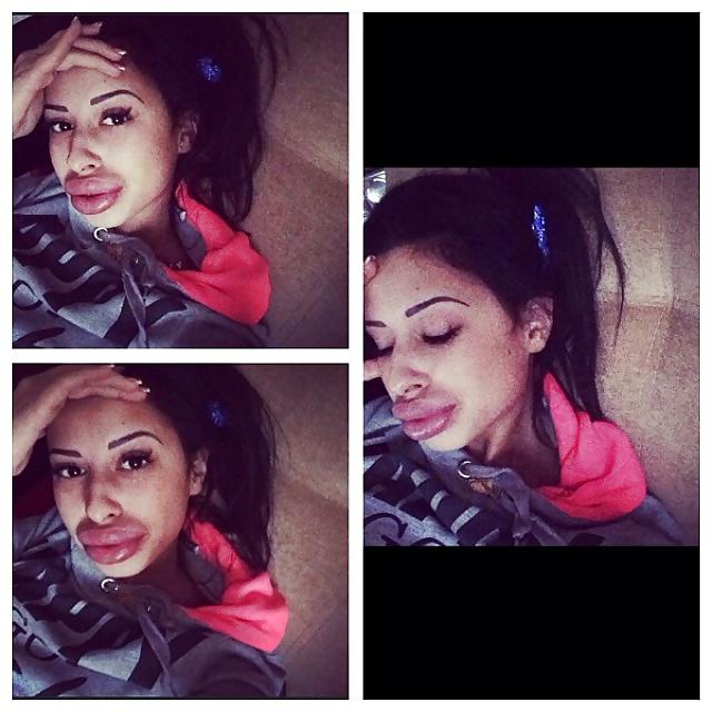 25P Big Lips Beauty Anya Khachaturyan (Apparently) 