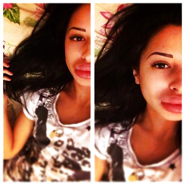 25P Big Lips Beauty Anya Khachaturyan (Apparently) 