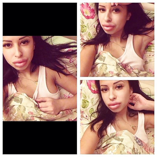 25P Big Lips Beauty Anya Khachaturyan (Apparently) 