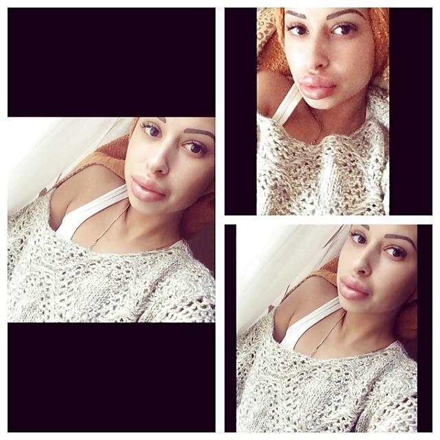 25P Big Lips Beauty Anya Khachaturyan (Apparently) 