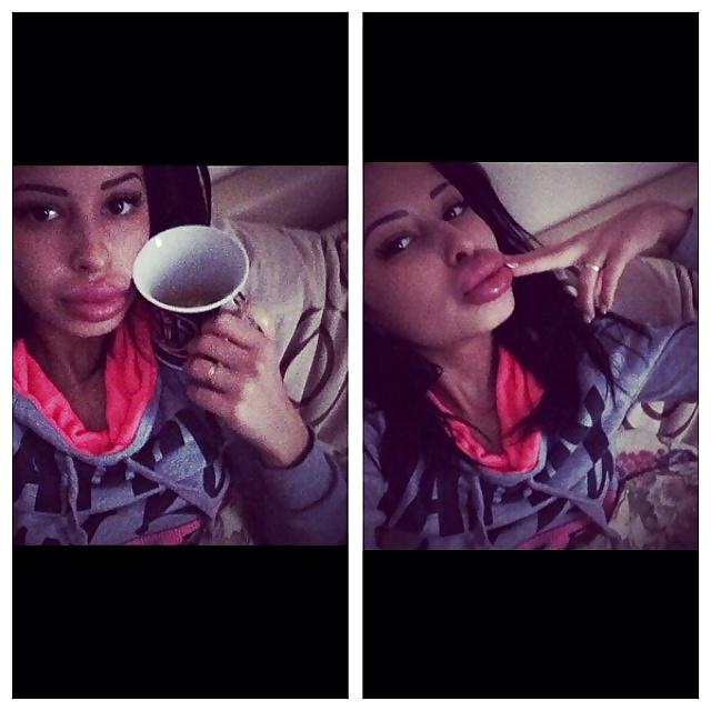 25P Big Lips Beauty Anya Khachaturyan (Apparently) 