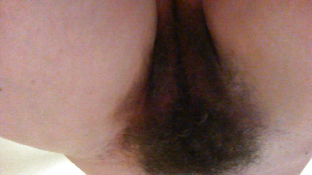 11P Still hairy