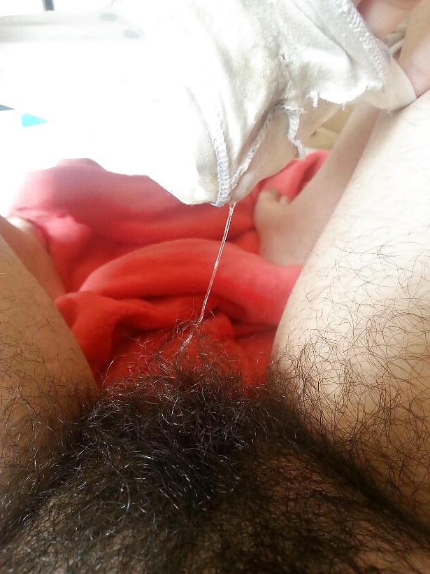 25P Amateur Hairy Beauty