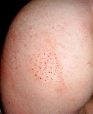 21P Compilation of mixed spanking session pictures