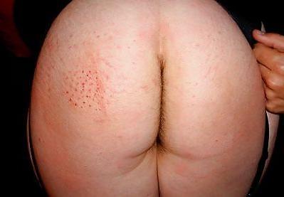 21P Compilation of mixed spanking session pictures