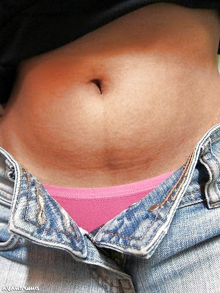 20P Desi chick