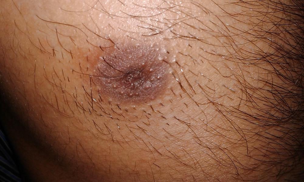 7P Desi guy Inverted Nipple