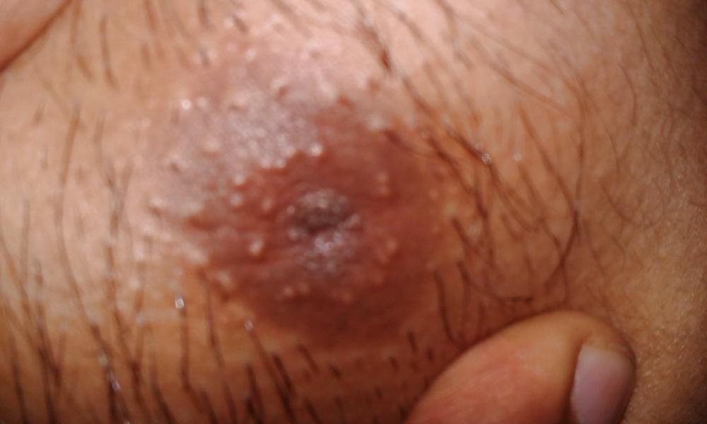 7P Desi guy Inverted Nipple