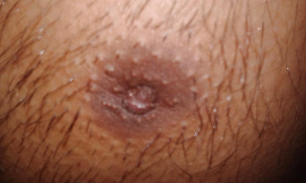 7P Desi guy Inverted Nipple