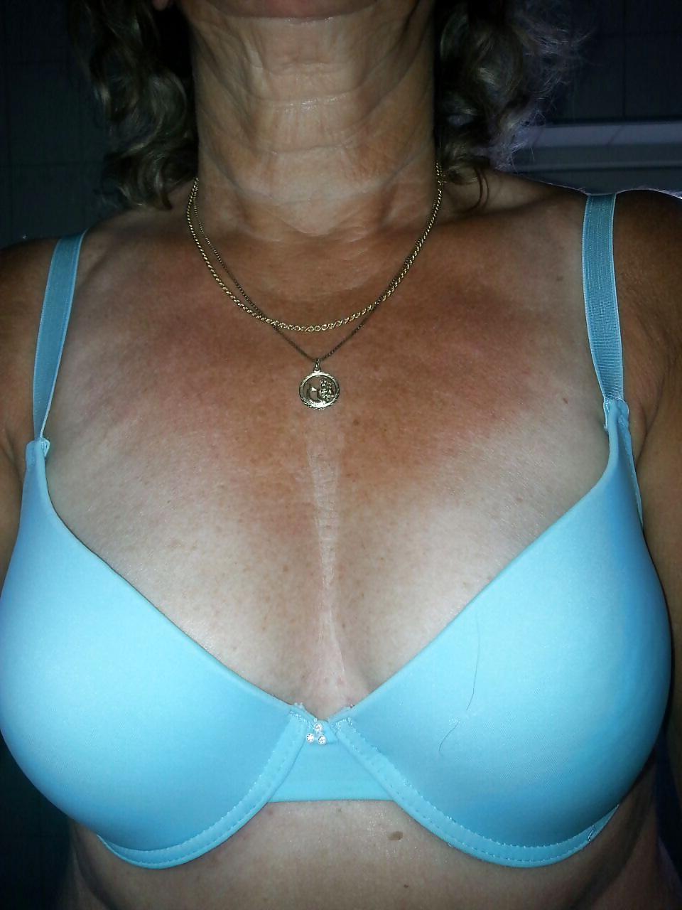 7P 64 years old dutch woman
