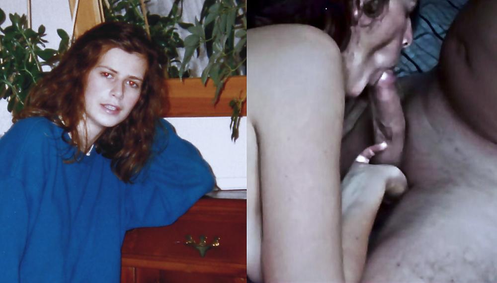 20P Before-after compilation