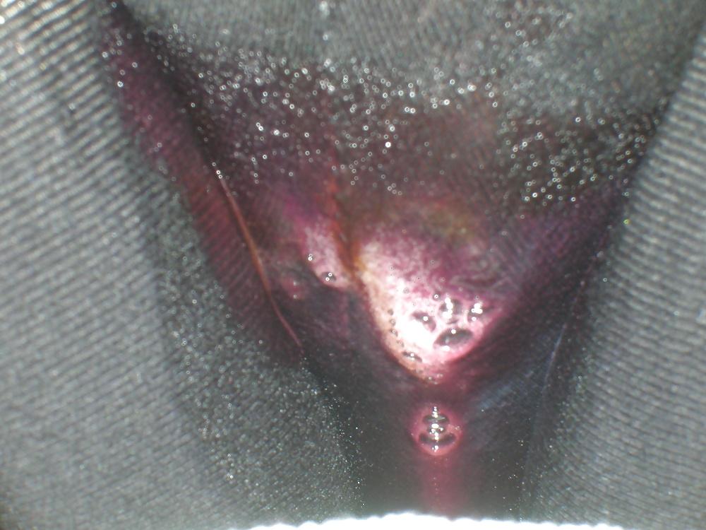 25P My messy crotch and leaky period gallery