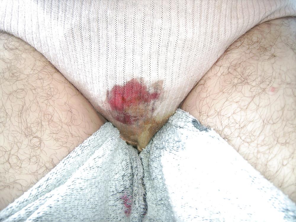 25P My messy crotch and leaky period gallery