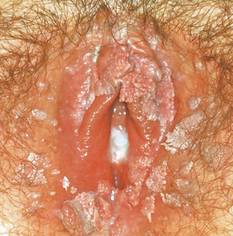 25P How long would you suck and lick these delicious