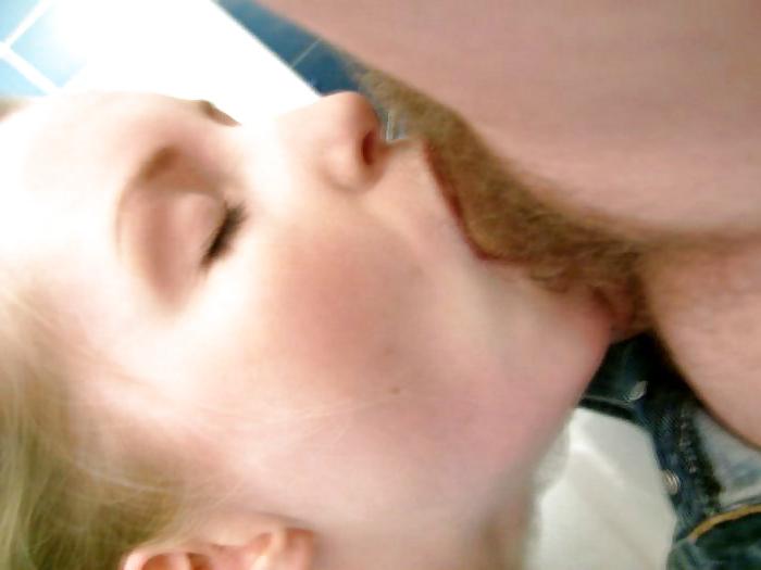 25P Oral Anna