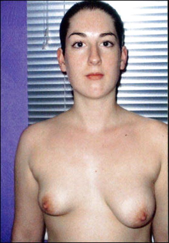 14P The Beauty of Fucked Up Tits Big and Small