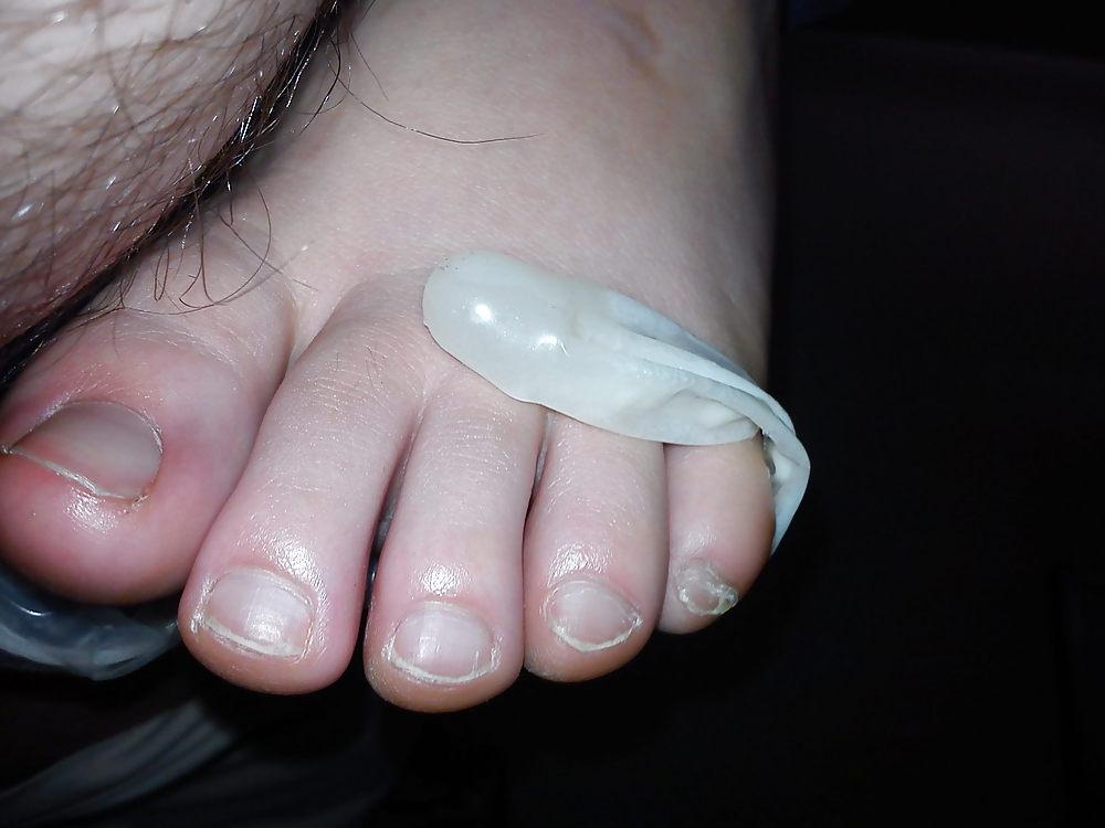 22P Used condom and exgf's feet