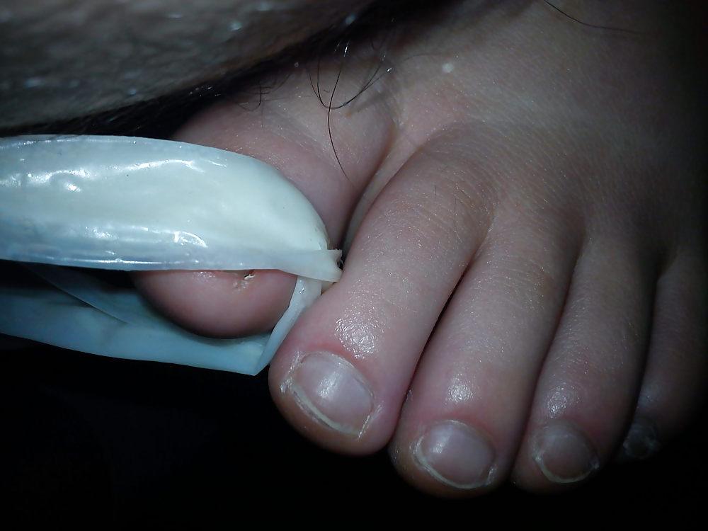 22P Used condom and exgf's feet