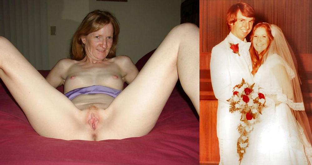 25P Dressed & undressed #15