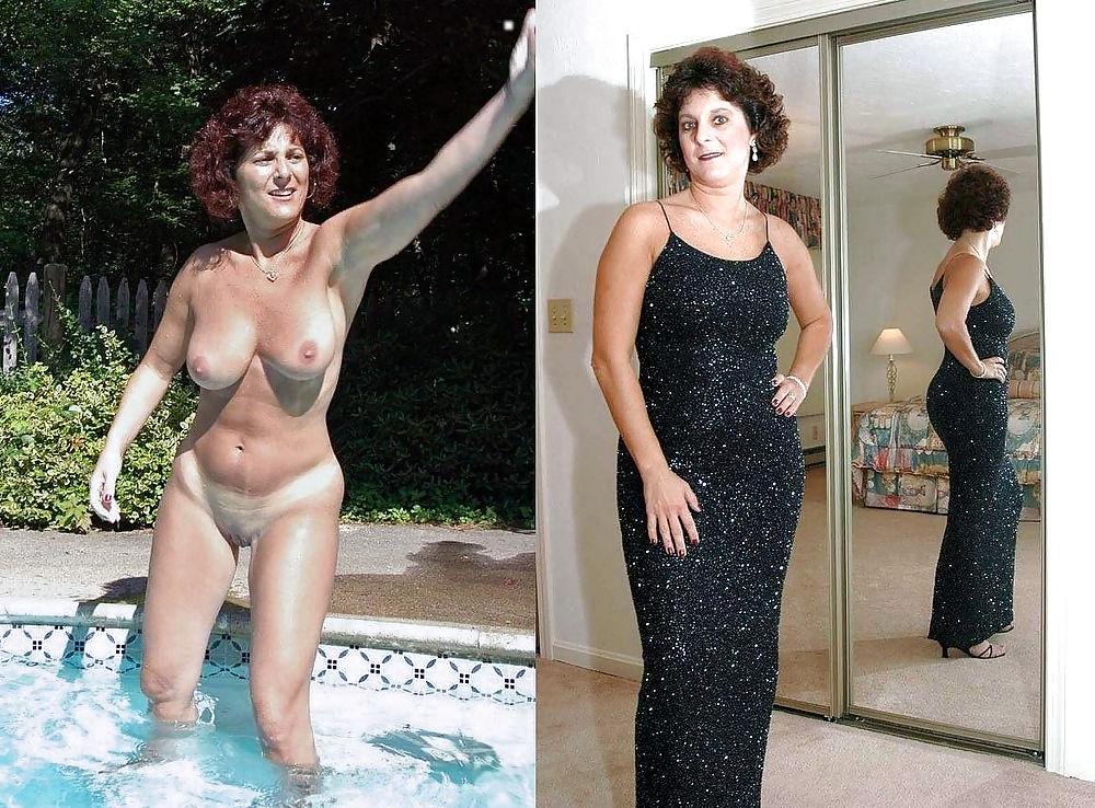25P Dressed & undressed #15