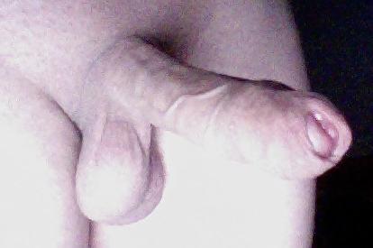 5P Foreskin Penis